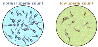 low sperm count vs normal sperm count image