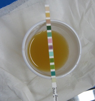 urine test illustration